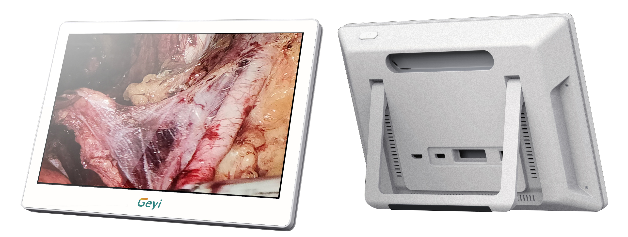 电子内窥镜图像处理器（便携式）